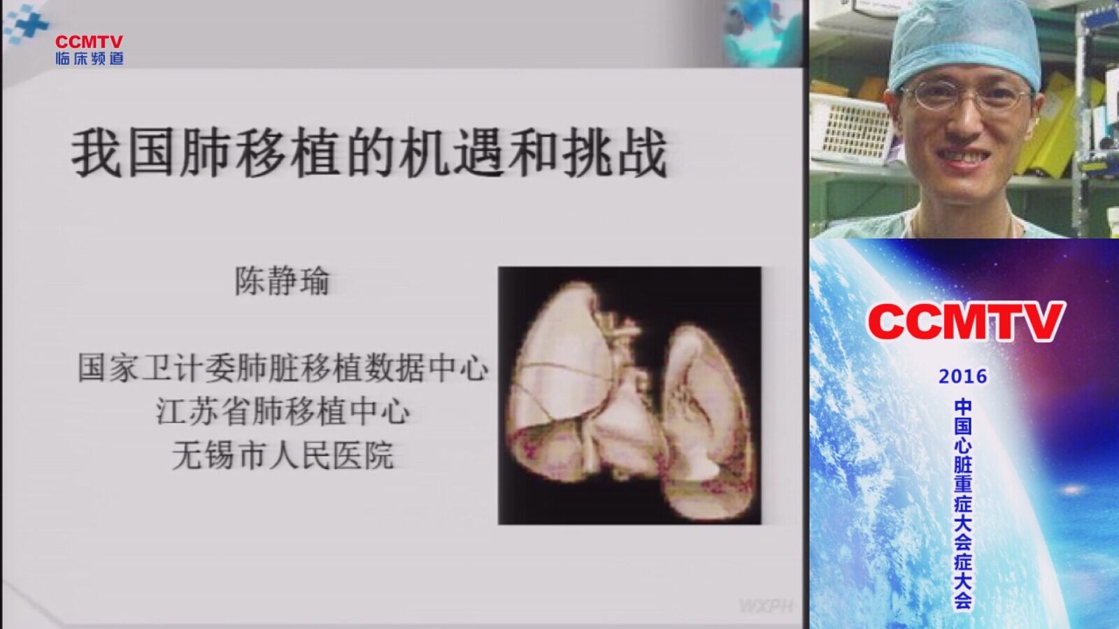陈静瑜：我国肺移植的机遇和挑战