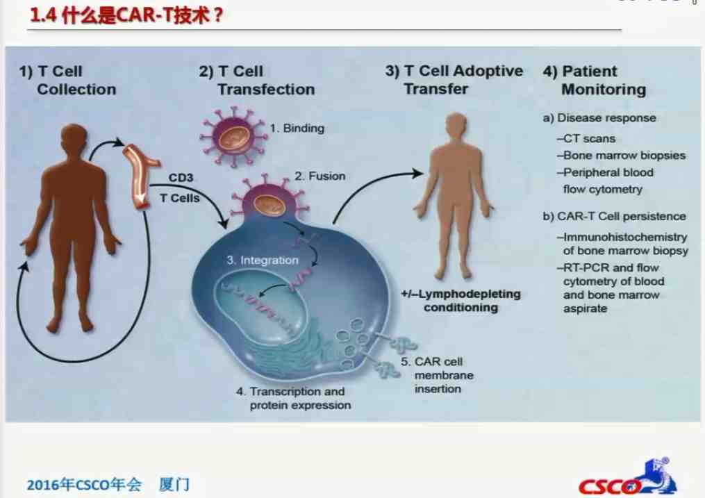 陈影：嵌合抗原受体修饰的NK-92 MI细胞对CD33+ AML细胞的杀伤研究