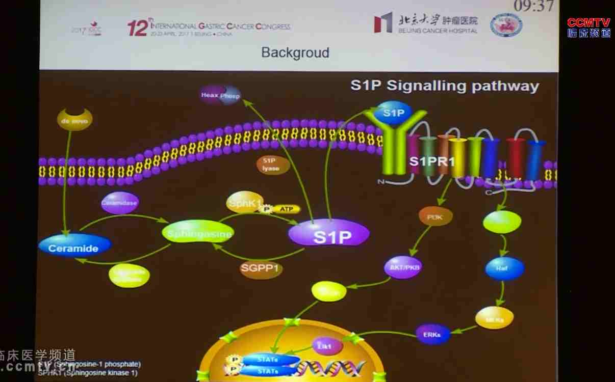 XY Gao：SPHK1的临床意义及其胃癌化疗耐药中的机制