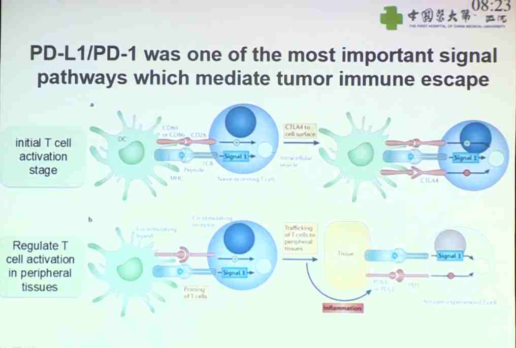 T Wen：基于PD-L1/PD-1/CD8综合评估的新免疫系统在II/III期胃癌预后模型中的应用