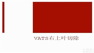 曹敏：VATS右上肺叶切除术