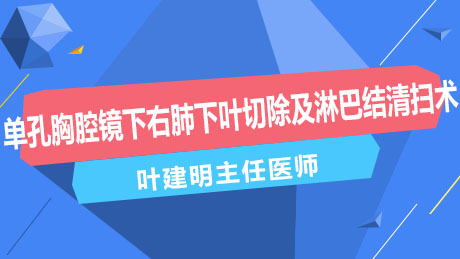 叶建明：单孔胸腔镜下右肺下叶切除及淋巴结清扫术