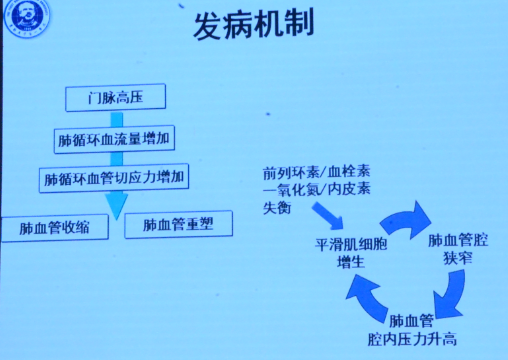 张尉华:门脉高压性肺动脉高压病因分析和临床管理