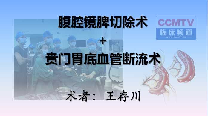 王存川：门脉高压腹腔镜脾切除术+贲门胃底血管断流术