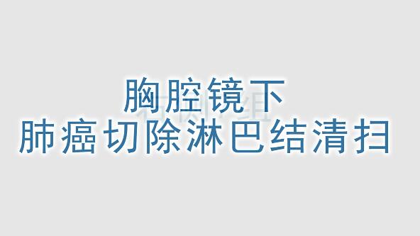 胸腔镜下肺癌切除淋巴结清扫