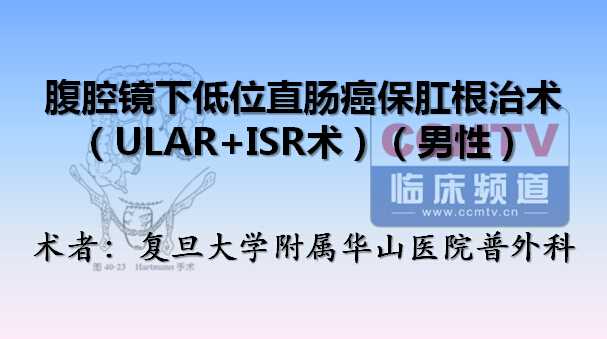 腹腔镜下低位直肠癌保肛根治术（ULAR+ISR术）（男性）
