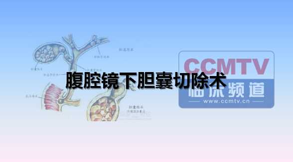甘磊磊：腹腔镜下胆囊切除术