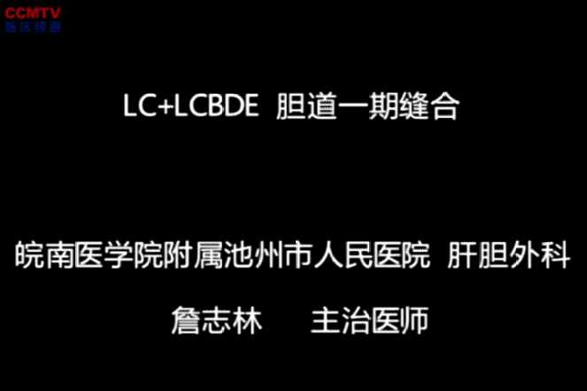 詹志林：腹腔镜胆囊切除+胆道探查取石一期缝合