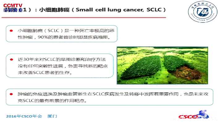 兰少伟：小细胞肺癌患者外周血MDSCs通过TGFβ1发挥免疫抑制作用
