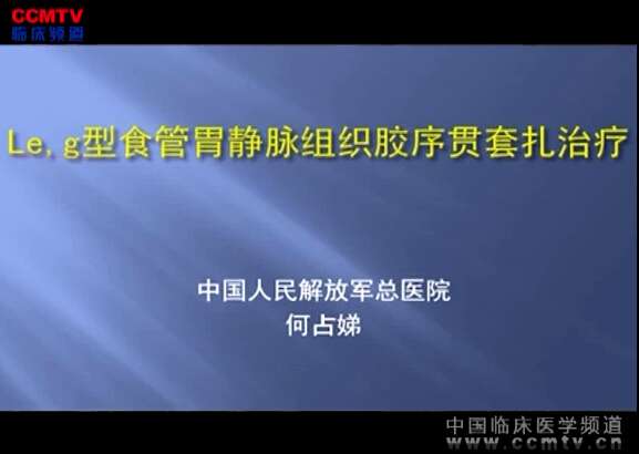 何占娣：Le.g型食管胃静脉组织胶序贯套扎治疗