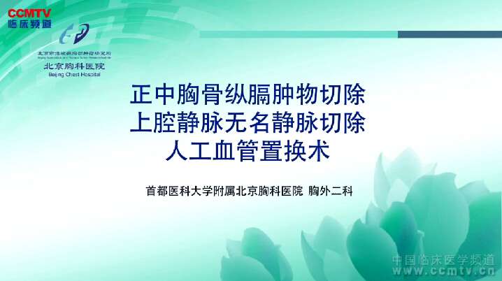 刘志东：正中胸骨纵膈肿物切除，上腔静脉无名静脉切除，人工血管置换术