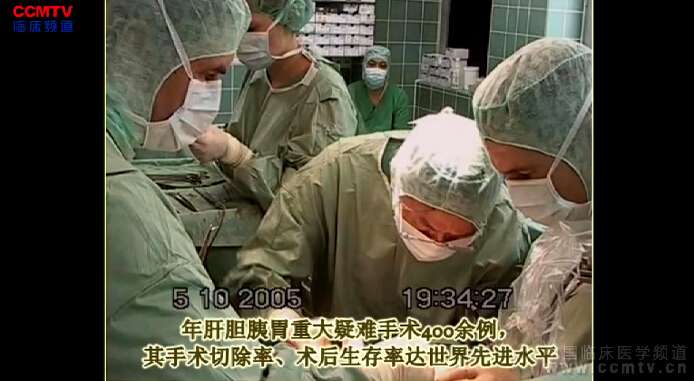 刘颖斌：胰十二指肠切除 - 捆绑式胰肠吻合、区域淋巴结清扫