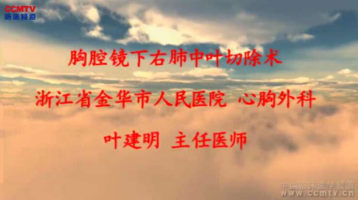 叶建明：胸腔镜下右肺中叶切除术