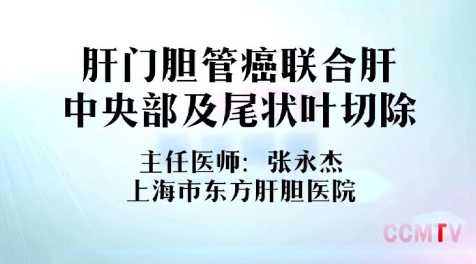 张永杰：肝门胆管癌联合肝中央部及尾状叶切除