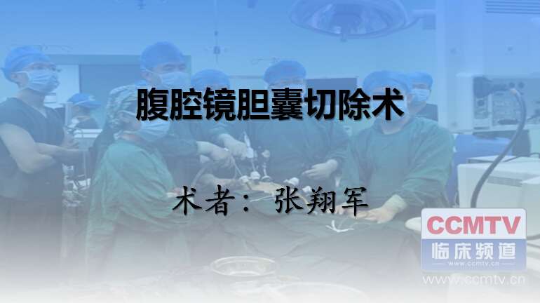 张翔军：腹腔镜胆囊切除术