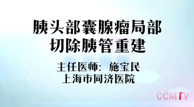 施宝民：胰头部囊腺瘤局部切除胰管重建手术视频