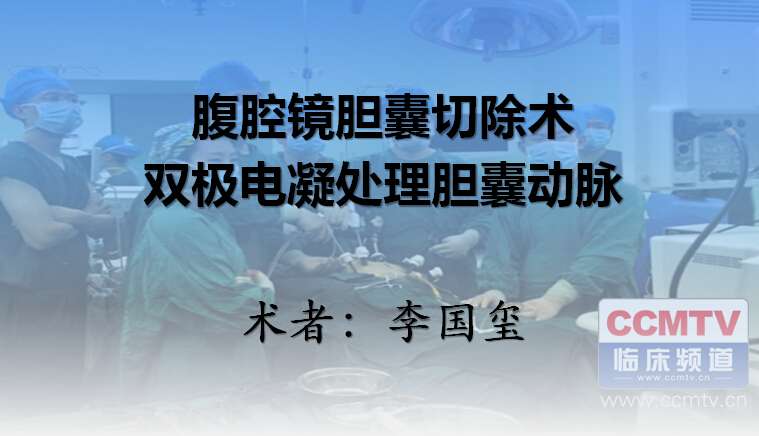 李国玺：腹腔镜胆囊切除术，双极电凝处理胆囊动脉