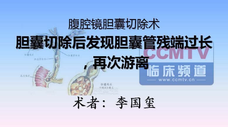 李国玺：腹腔镜胆囊切除后发现胆囊管残端过长，再次游离