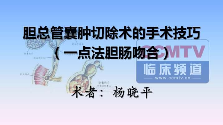 杨晓平：腹腔镜胆总管囊肿切除术的手术技巧（一点法胆肠吻合）