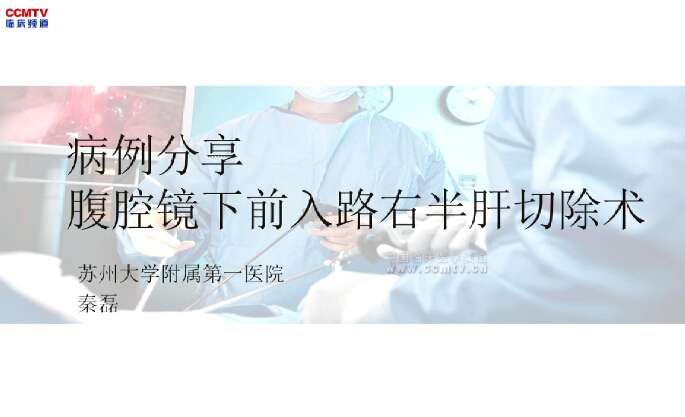 秦磊：腹腔镜下前入路右半肝切除术