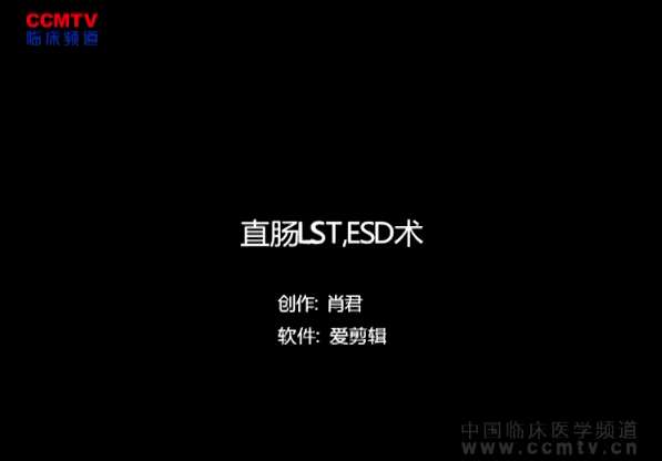 肖君：直肠LST圈套器辅助牵引ESD + 医用胶原蛋白海绵创面封闭术