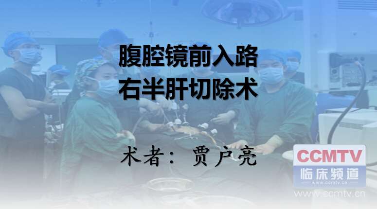贾户亮：腹腔镜前入路右半肝切除术