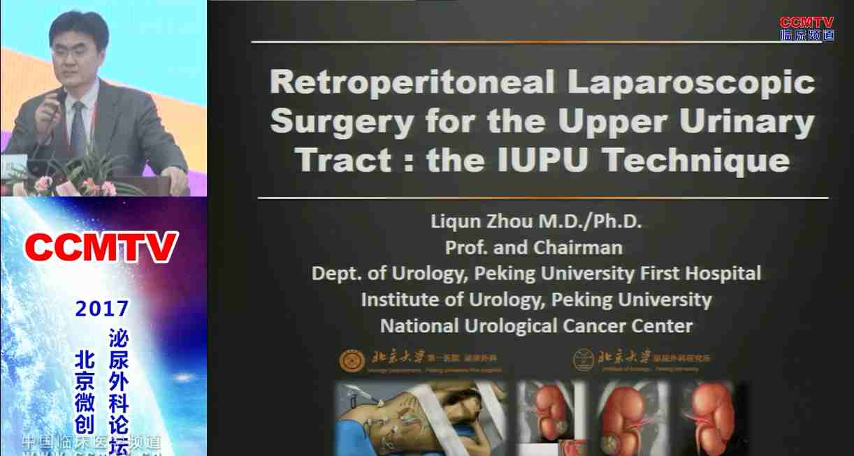 周利群：腹腔镜北大医院泌尿所（IUPU）技术