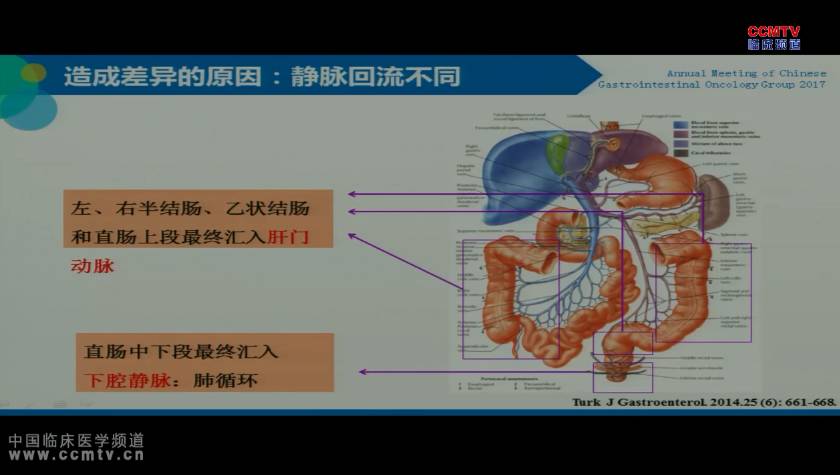 张艳桥：结直肠癌肺转移的治疗现状及研究进展