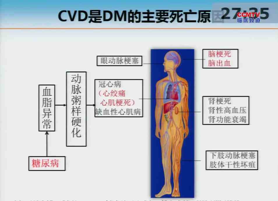 潘琦：北京地区2型糖尿病患者他汀类药物使用状况调查